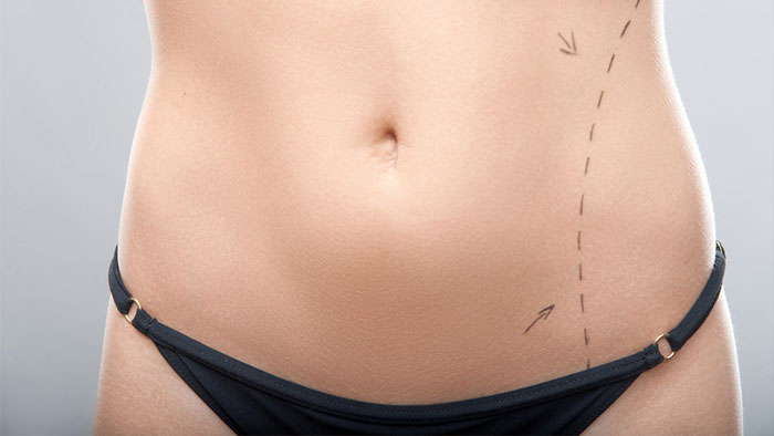 Реконструкция и коррекция груди собственным жиром